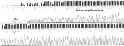 Detection of exon 5 c.577del variant of human erythropoietin gene in whole blood, dried blood spots and urine samples for doping control